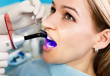 A woman receiving tooth-colored fillings
