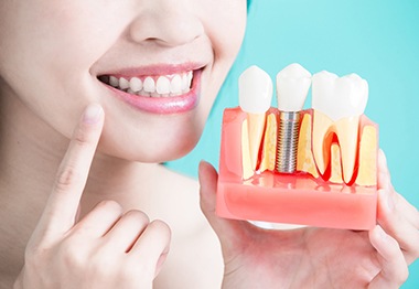 Woman pointing to her smile while holding up a model of a dental implant in a jawbone