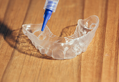 A customized whitening tray complete with the bleaching gel that is designed to fill the tray