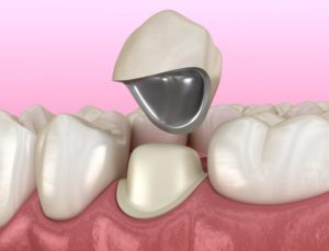 dental crown 3D illustration